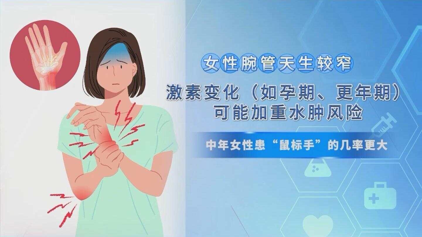 中年女性患“鼠标手”的概率更大，患上“鼠标手”怎么申请工伤待遇？-第1张图片