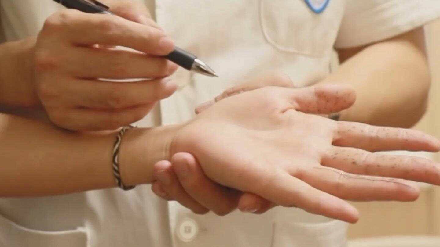 中年女性患“鼠标手”的概率更大，患上“鼠标手”怎么申请工伤待遇？-第2张图片
