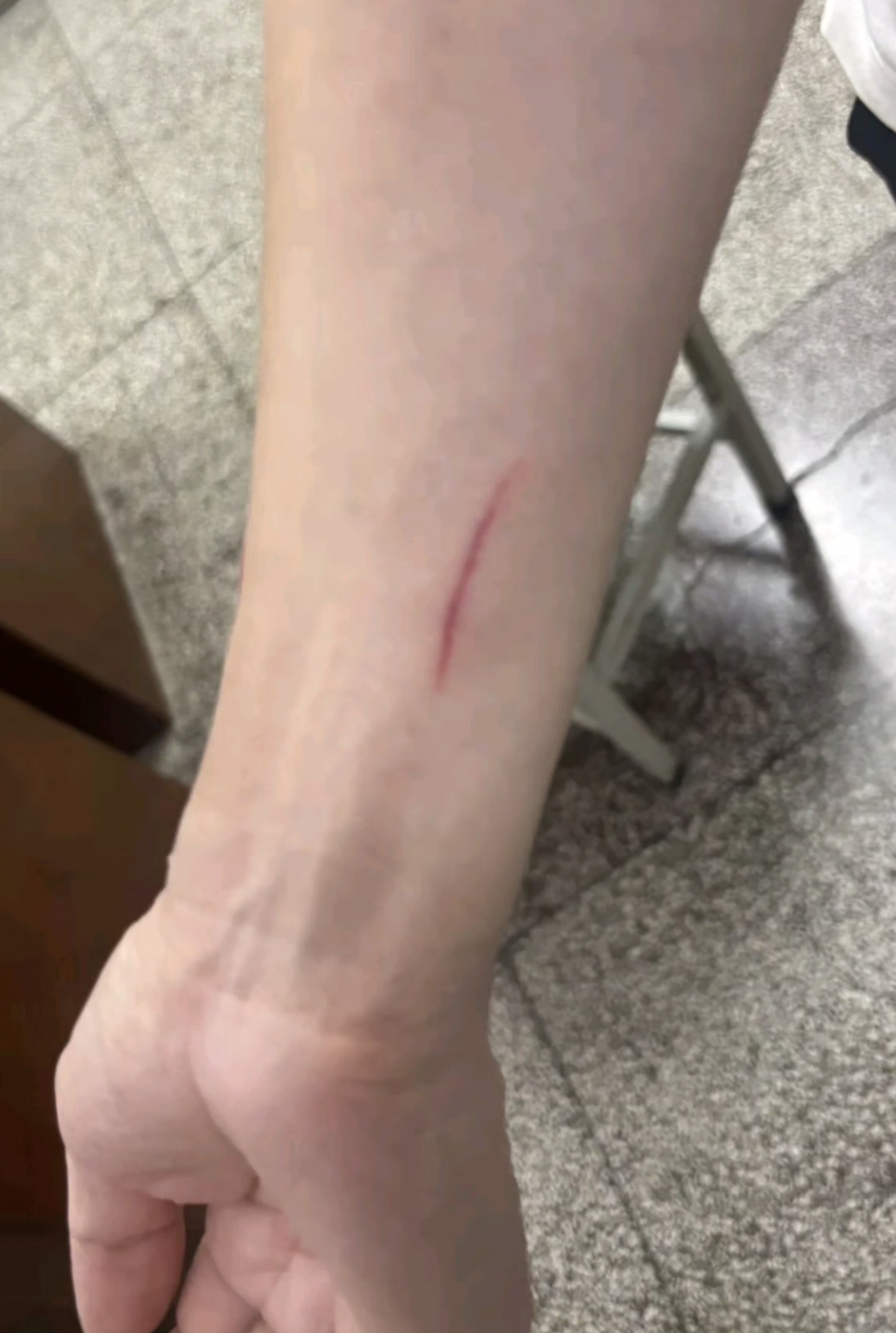 网友称丈夫被酒店养的猫抓伤，酒店回应：索赔2万元不合理，无法承担-第3张图片
