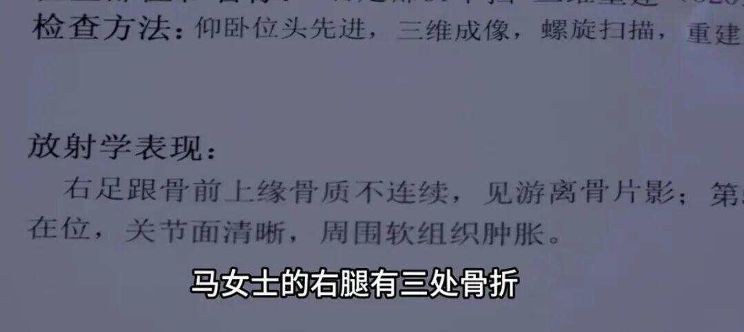 共享单车骑行中突然被锁致多人摔伤？网友：建议换回机械锁-第2张图片