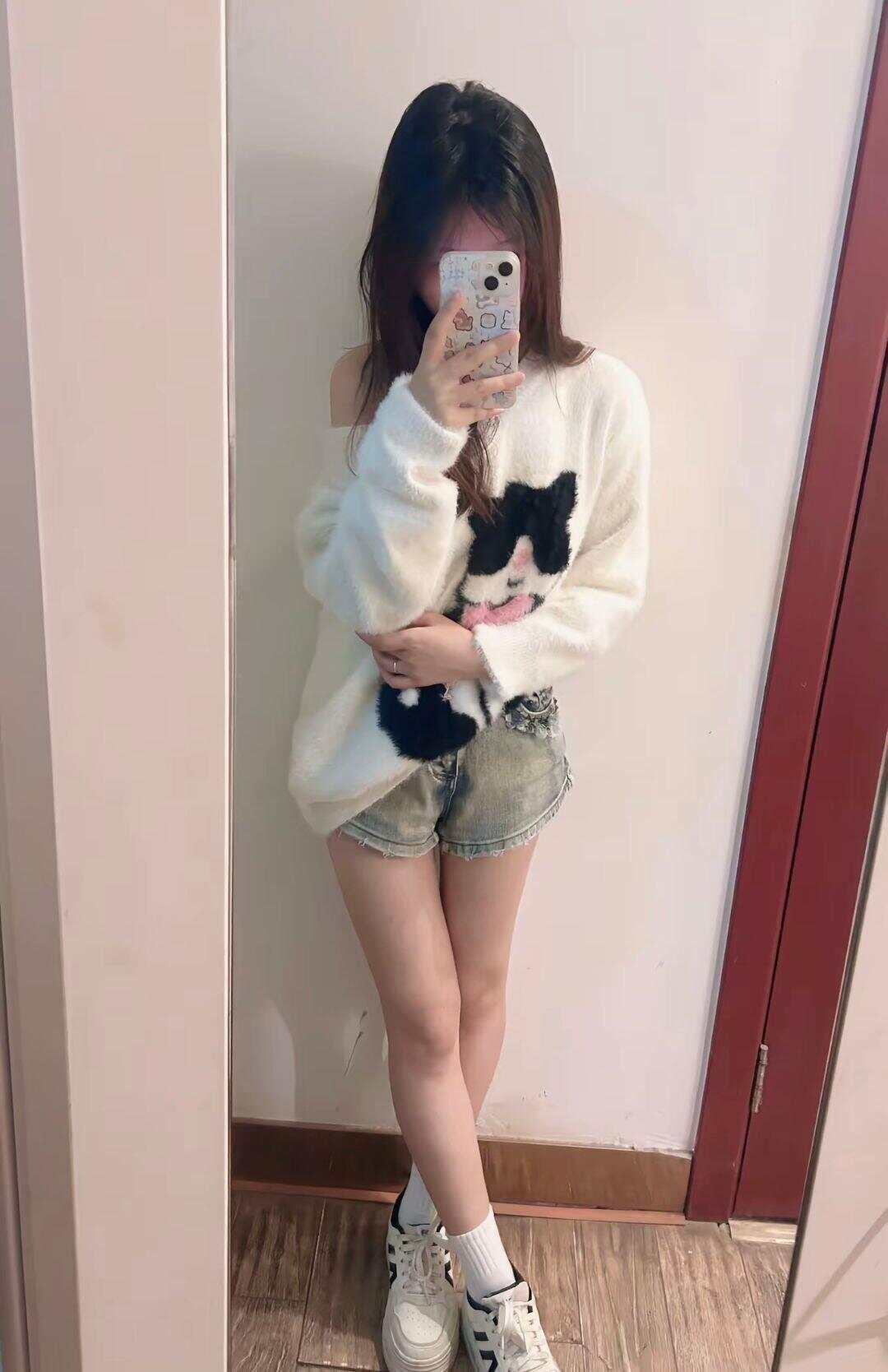 21岁女生确诊白血病4个多月后离世，身上曾出现莫名瘀青，医生提醒→-第3张图片